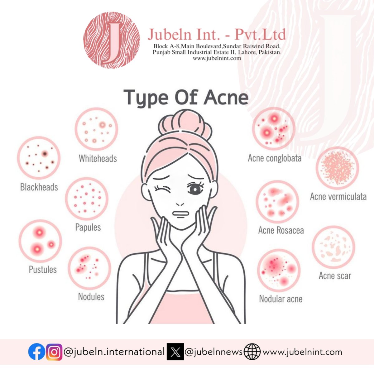 JUBELNNEWS's tweet photo. Acne is a common skin condition that happens when hair follicles under the skin become clogged.
 #jubelnint #cosmeticslover #jubelncosmetics #manufacturer #products #personalcare #makeup #manufacturing #cosmetics #fashion #skincare #beauty #makeuptutorial 
#acne #types https://t.co/aHYCzypRT1