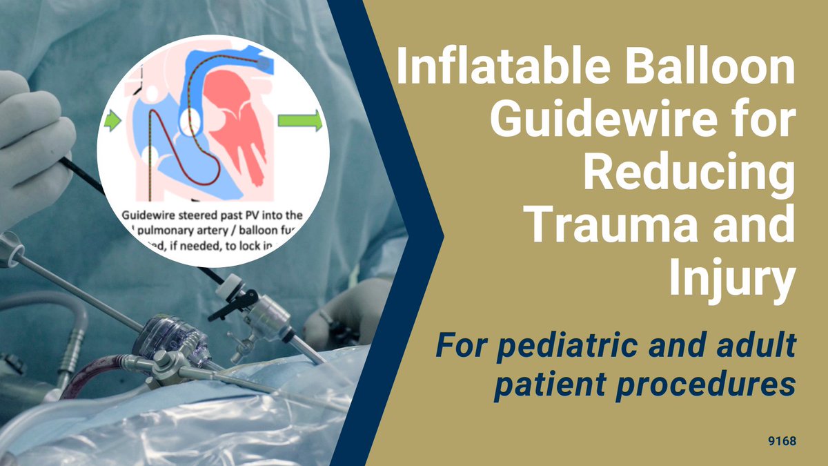 GaTechOTL's tweet photo. #AvailableForLicense: Versatile #balloonguidewire design increases control and minimizes trauma for pediatric and adult #interventionalmedicalprocedures. @CoulterBME 
#interventionalcardiology #pediatricinterventionalcardiology #continuumrobot

https://t.co/sejUoviTpo https://t.co/jZfcry0Nvy
