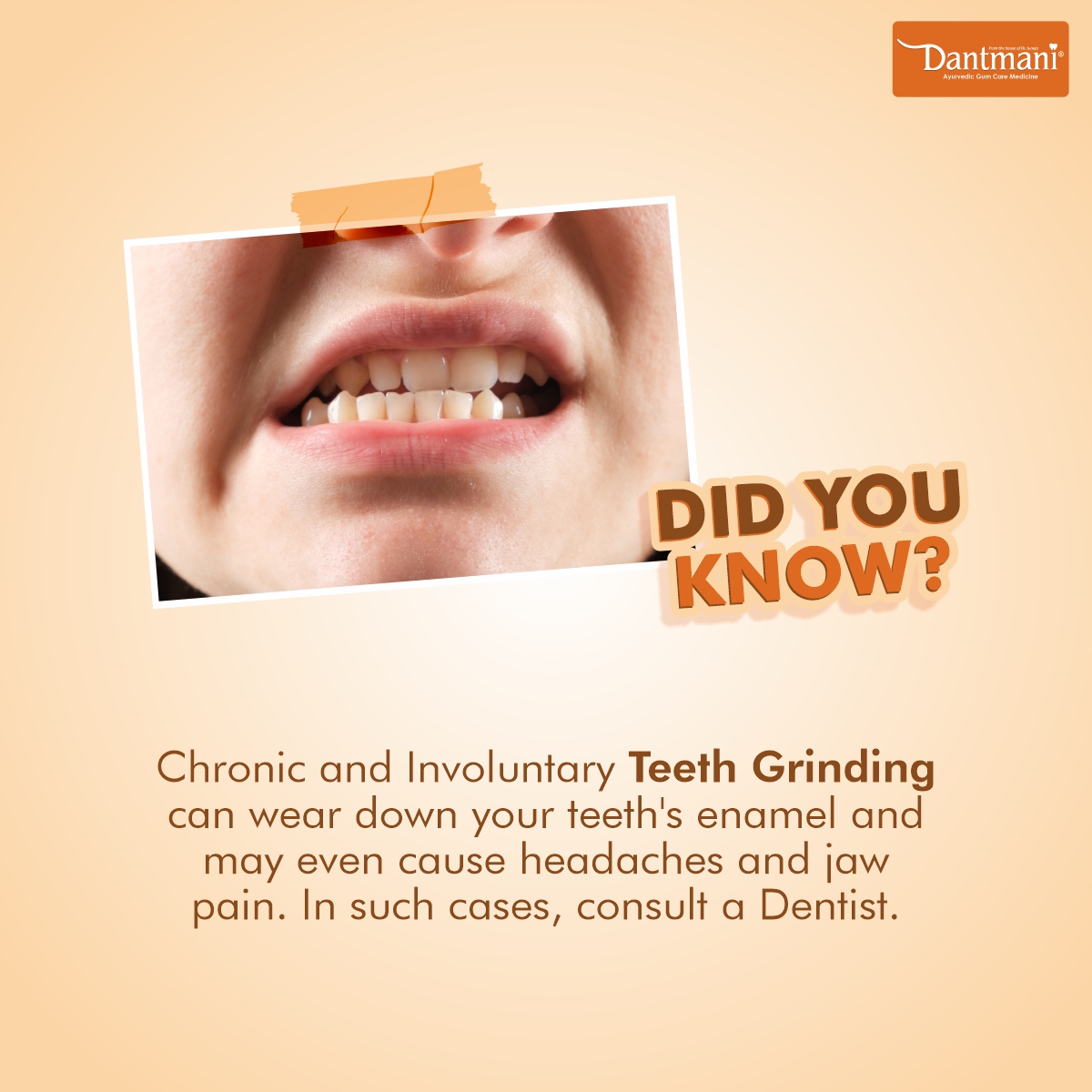 DantMani's tweet photo. Now you know that teeth grinding can have detrimental effects on your teeth health. So, make sure to get it professionally checked.
#DantMani #AyurvedicToothpaste #DentalCare #HealthyGums #HealthyTooth #toothcare #DidYouKnow https://t.co/hlkrEHiUKs