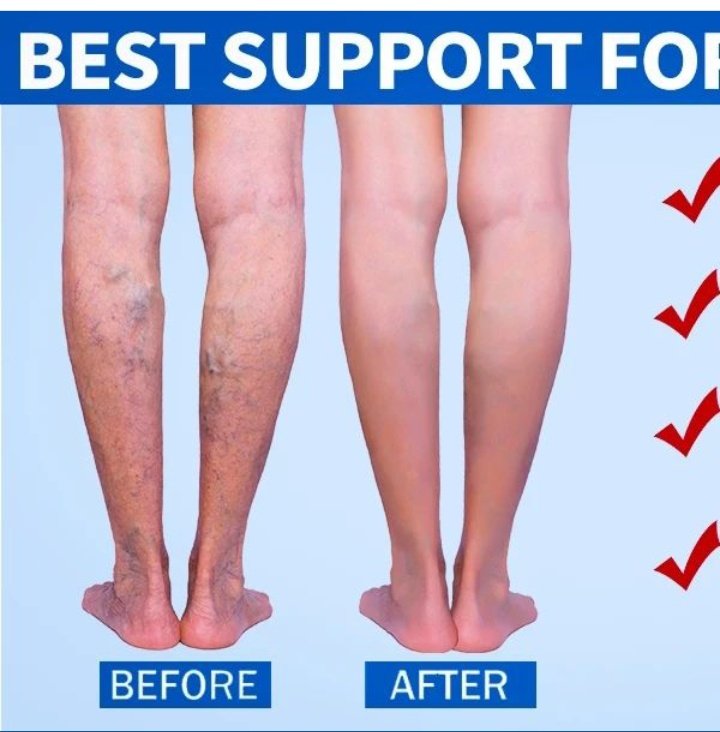 apuke_emy's tweet photo. Compression socks are  designed to increase blood circulation.They are made to fit tightly on the legs .They can also be used by people that their job requires extensive standing or walking
Khalwale Kate Actress Kibe LGBTQ baba the 6th naivasha Kisii Kuria marriage simp https://t.co/EDHL2pg29V