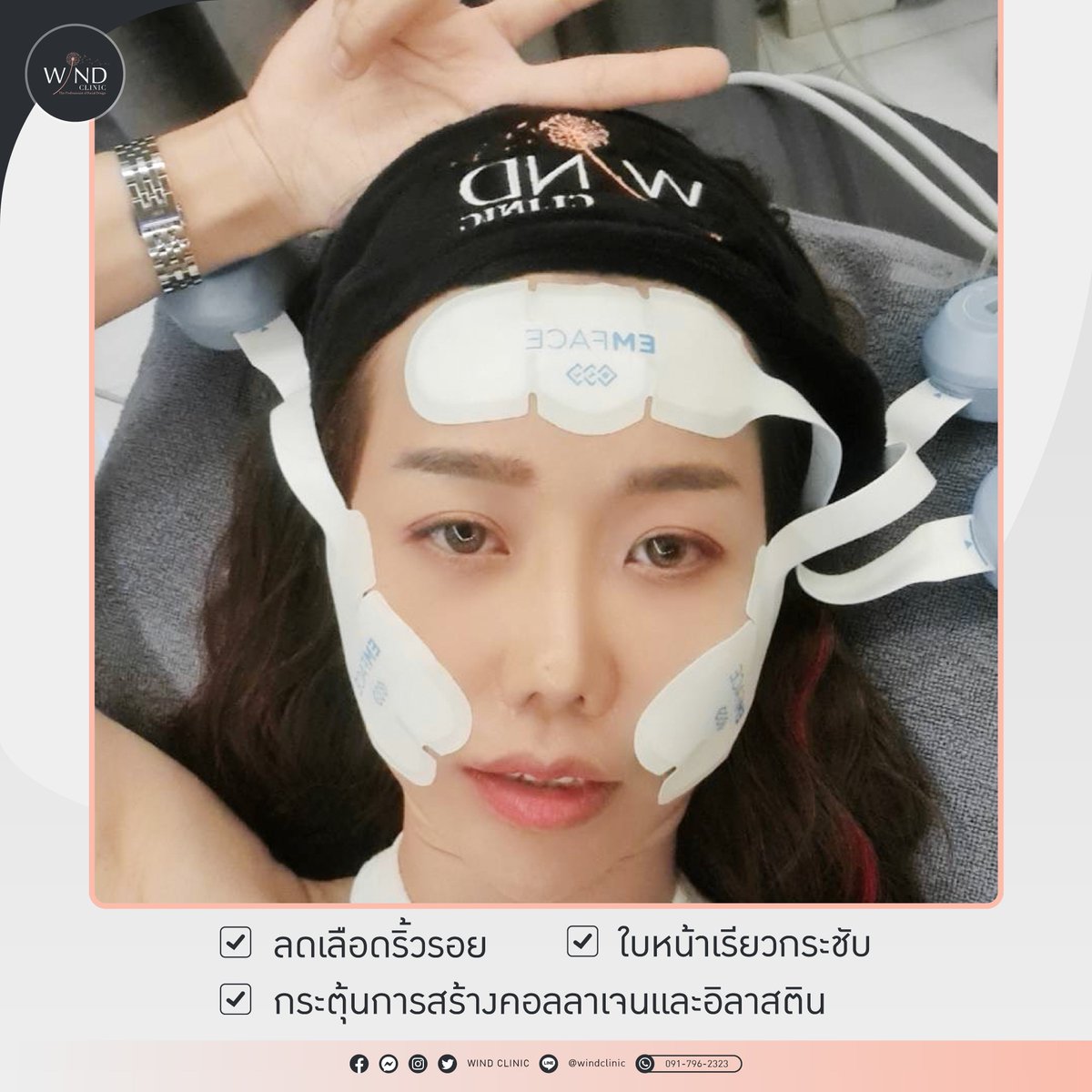 windclinic's tweet photo. ยกไว ไม่เจ็บ นวัตกรรมใหม่ของการยกกระชับ
𝗘𝗠𝗙𝗔𝗖𝗘  กระตุ้นลึกถึงชั้นกล้ามเนื้อ
✔  ลดริ้วรอย
✔ แก้มยก
✔  ลดร่องแก้ม
✔ ใบหน้าเรียว กรอบหน้าชัด
✔ กระตุ้นการสร้างคอลลาเจนและอิลาสติน

✅ ใช้เวลาเพียง 20 นาที

#หมอบาส_นายแพทย์เฉลิมชัย_ศรีอัครพงศ์
#ปรับรูปหน้า  #ปีใหม่ 
#emface https://t.co/cPbYcvfAK3