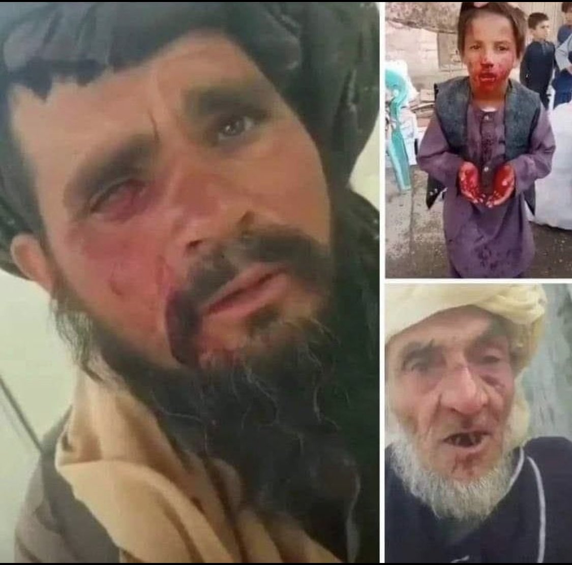 Pakistan’s atrocities on #AfghanRefuges، but 🌎is 🫣.

<a href="/hrw/">Human Rights Watch</a> <a href="/UNHumanRights/">UN Human Rights</a> @amnestyasia <a href="/UN_Vienna/">UN Vienna</a> <a href="/UNGeneva/">United Nations Geneva</a> <a href="/UNWatch/">UN Watch</a> <a href="/UNHCRAfg/">UNHCR Afghanistan</a> <a href="/Refugees/">UNHCR, the UN Refugee Agency</a> <a href="/RefugeesMedia/">UNHCR News</a> <a href="/UNHCRPakistan/">UNHCR Pakistan</a> <a href="/UN_Vienna/">UN Vienna</a> 
<a href="/UN_HRC/">UN Human Rights Council</a> <a href="/antonioguterres/">António Guterres</a> <a href="/RefugeesIntl/">Refugees International</a> <a href="/nytimes/">The New York Times</a> <a href="/washingtonpost/">The Washington Post</a> <a href="/thedispatch/">The Dispatch</a>  <a href="/thehill/">The Hill</a> <a href="/NPR/">NPR</a> <a href="/UNICEF/">UNICEF</a>