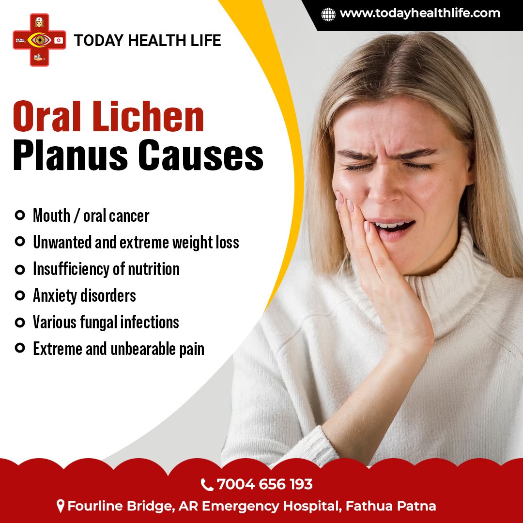 Oral Lichen Planus Causes

👉todayhealthlife.com

#orallichenplanus #oral #tooth #pain #health #healthyliving #healthylivingtips #todayhealthlife #healthtips101 #HealthyChoices