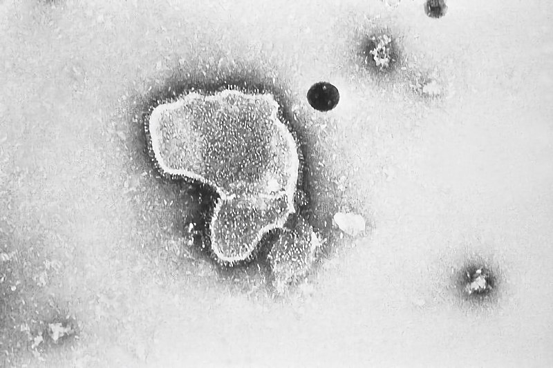 ASMicrobiology's tweet photo. #MicrobeoftheMonth! Who am I?

1) When I was discovered, I was named "chimpanzee coryza agent." 
2) I infect most people by the time they are 2 years old.
3) I cause cells to fuse with one another.

Think you know? Comment below! https://t.co/pFnCXJlC1H