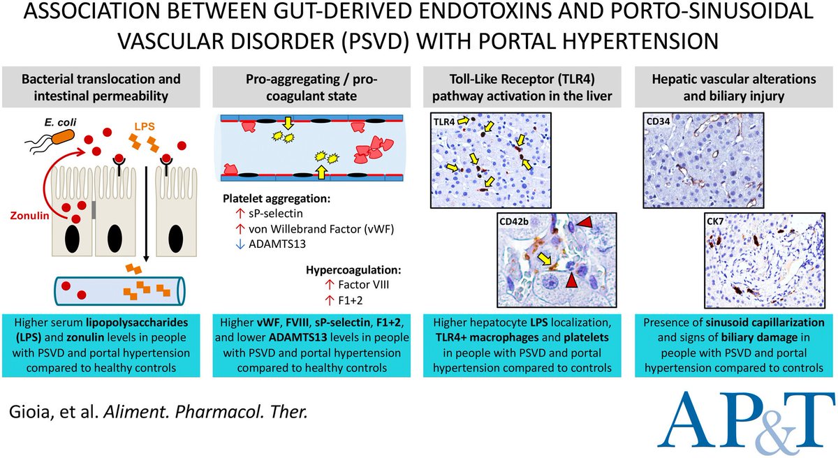 Association between gut-derived endotoxins and porto-sinusoidal vascular disorder with portal hypertension - read at bit.ly/44TASiU
#livertwitter