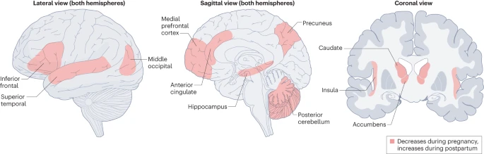 Nature Rev Neurosci (@natrevneurosci) on Twitter photo The transition to motherhood: linking hormones, brain and behaviour —by <a href="/Camila_SerBar/">Camila Servin Barthet</a>, <a href="/MagdaMartinezGa/">Magdalena Martínez-García PhD🦋</a>, <a href="/ClaraPretus/">Follow @ClaraPretus on Bluesky</a>, <a href="/DiePaternina/">María Paternina-Die</a>, Anna Soler, Olha Khymenets, Óscar J. Pozo, <a href="/LeunerLab/">LeunerLab</a>, <a href="/OVilarroya/">Oscar</a> & <a href="/susanna_carmona/">Susana Carmona</a>
go.nature.com/3RhbFfb
<a href="/neuromaternal/">neuromaternal</a> <a href="/BeMotherProject/">BeMother (BabyBrain)</a> The transition to motherhood: linking hormones, brain and behaviour —by <a href="/Camila_SerBar/">Camila Servin Barthet</a>, <a href="/MagdaMartinezGa/">Magdalena Martínez-García PhD🦋</a>, <a href="/ClaraPretus/">Follow @ClaraPretus on Bluesky</a>, <a href="/DiePaternina/">María Paternina-Die</a>, Anna Soler, Olha Khymenets, Óscar J. Pozo, <a href="/LeunerLab/">LeunerLab</a>, <a href="/OVilarroya/">Oscar</a> & <a href="/susanna_carmona/">Susana Carmona</a>
go.nature.com/3RhbFfb
<a href="/neuromaternal/">neuromaternal</a> <a href="/BeMotherProject/">BeMother (BabyBrain)</a>
