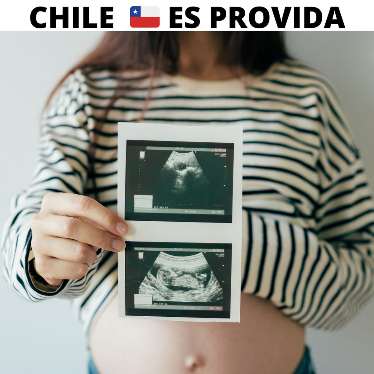 MAngelicaPurce1's tweet photo. #ChileEsProvida
En MI cuerpo late OTRO corazón 
ES OTRA VIDA 
ES LA VIDA que entre todos DEBEMOS PROTEGER
La Constitución debe proteger La Vida de toda corriente, política, e ideologia de turno
@gbeckera 
@EluchansEdmundo 
@ElMercurio_cl https://t.co/mxHmdKqMU0