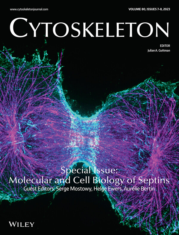 Cytoskeleton Journal (@cytoskeljournal) on Twitter photo The #Molecular and #Cell #Biology of #Septins #Specialissue is now out in #CYTOSKELETON <a href="/CytoskelJournal/">Cytoskeleton Journal</a> ! Huge thank you to our guest editors Serge Mostowy <a href="/MostowyLab/">Mostowy Lab</a> , Helge Ewers <a href="/ewers_helge/">Ewerslab</a> and Aurélie Bertin @BertinAurlie2 for putting together such a wonderful issue! The #Molecular and #Cell #Biology of #Septins #Specialissue is now out in #CYTOSKELETON <a href="/CytoskelJournal/">Cytoskeleton Journal</a> ! Huge thank you to our guest editors Serge Mostowy <a href="/MostowyLab/">Mostowy Lab</a> , Helge Ewers <a href="/ewers_helge/">Ewerslab</a> and Aurélie Bertin @BertinAurlie2 for putting together such a wonderful issue!