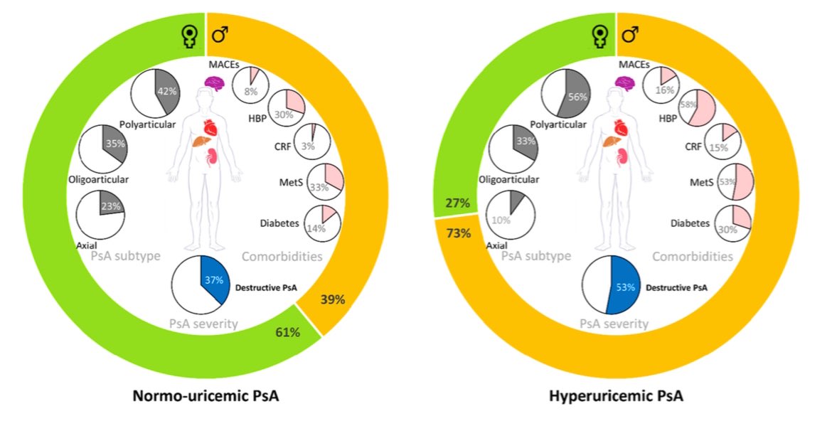 reumacia's tweet photo. Hiperuricemia y artritis psoriásica: “la combi completa” 2️⃣ x 1️⃣
Acceso abierto 🔓 https://t.co/dNg7Xyt96n https://t.co/4quV9ZSxVW