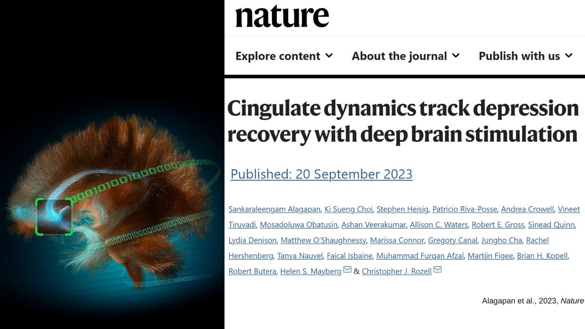 Excited to share this paper using new neurotech and explainable AI to advance DBS for treatment resistant #depression (TRD). Team effort including @HelenMaybergMD, @sankar_alagapan and Patricio Riva-Posse. Summary thread! go.nature.com/48lmlzC @nature PC: Mike Halerz