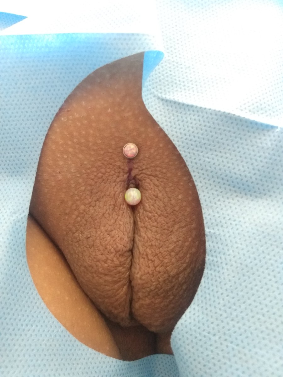 LimaSatine's tweet photo. Christina Piercing com Jóia de titânio e opala rosa 💕 https://t.co/1rVpB4y6lM