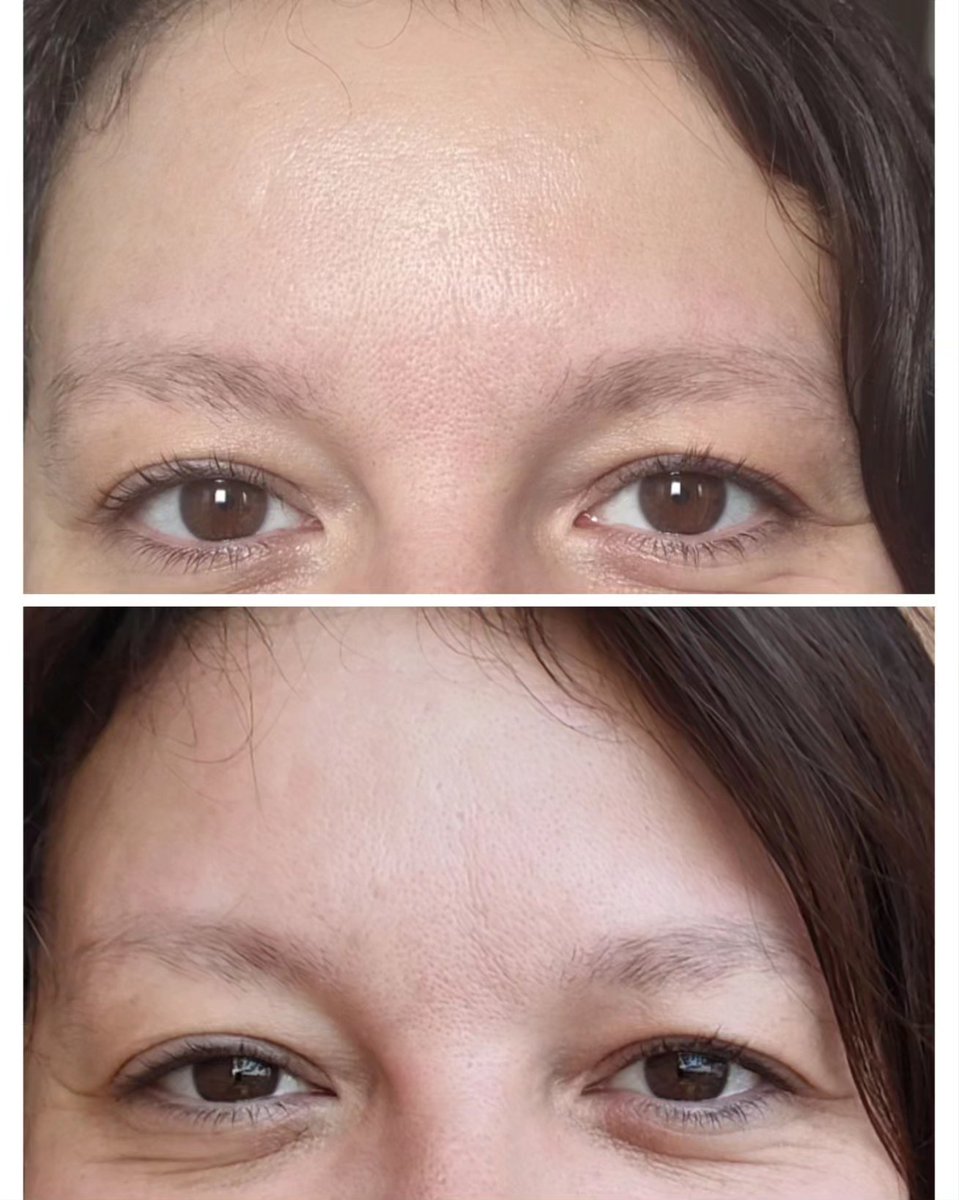 mmeechantillon's tweet image. Après plus d'un mois d'utilisation, voilà les résultats de l'effet #bonnemine d'#eyecarecosmetics 
Ma peau est:
- moins brillante
- mes pores sont plus resserrés
-la peau est visiblement plus nette
Merci @monvanityideal pour cette jolie séléction
 #monvanityideal #bonnemine