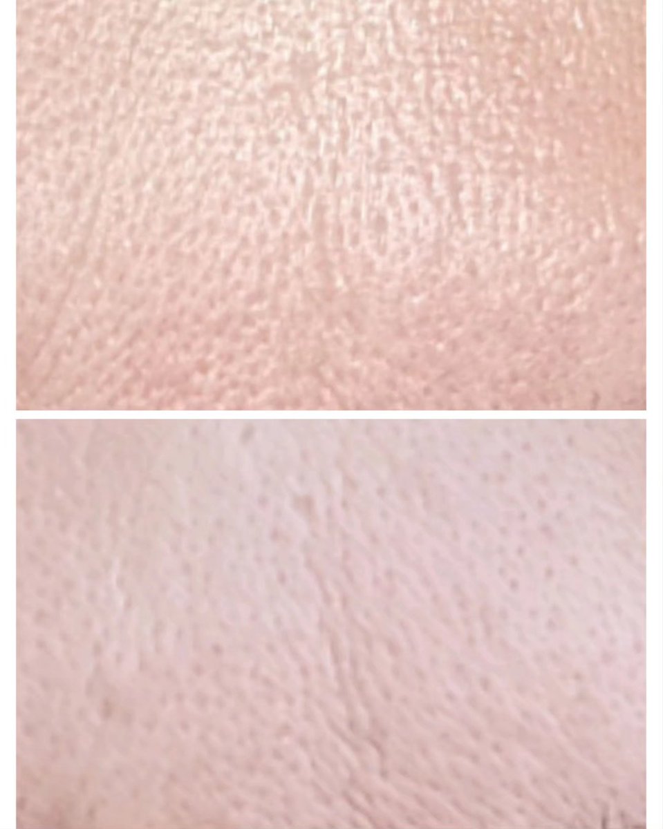 mmeechantillon's tweet image. Après plus d'un mois d'utilisation, voilà les résultats de l'effet #bonnemine d'#eyecarecosmetics 
Ma peau est:
- moins brillante
- mes pores sont plus resserrés
-la peau est visiblement plus nette
Merci @monvanityideal pour cette jolie séléction
 #monvanityideal #bonnemine