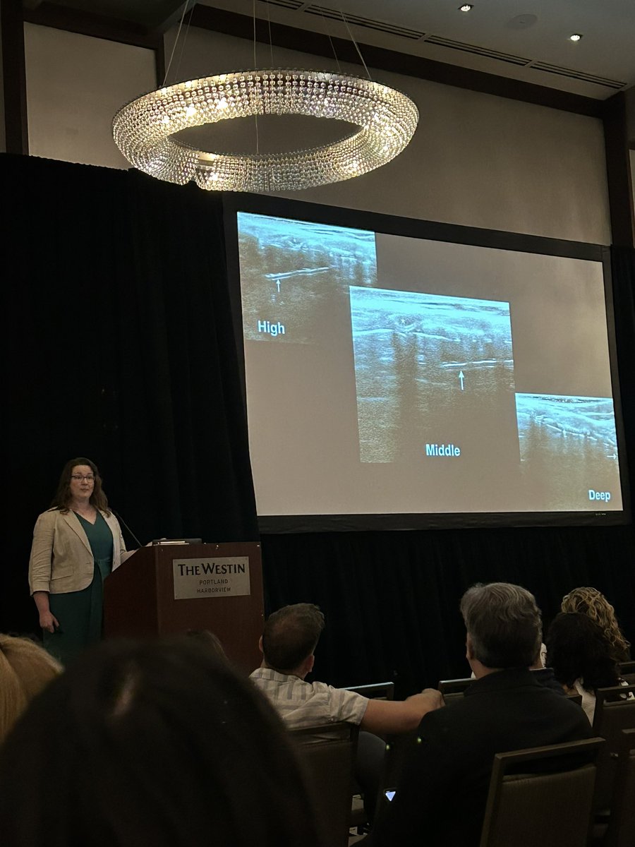 Rush EM Ultrasound (@rushemsono) on Twitter photo Amazing fellow lightning talk by our very own Dr. Schraft at #SCUF23
.
We should all be using ultrasound for airway confirmation and Dr. Schraft explains why it’s easy as 1,2,3!
.
<a href="/SCUFellowships/">Society of Clinical Ultrasound Fellowships</a> <a href="/RushEmergency/">RUSH Emergency Medicine Residency</a> Amazing fellow lightning talk by our very own Dr. Schraft at #SCUF23
.
We should all be using ultrasound for airway confirmation and Dr. Schraft explains why it’s easy as 1,2,3!
.
<a href="/SCUFellowships/">Society of Clinical Ultrasound Fellowships</a> <a href="/RushEmergency/">RUSH Emergency Medicine Residency</a>
