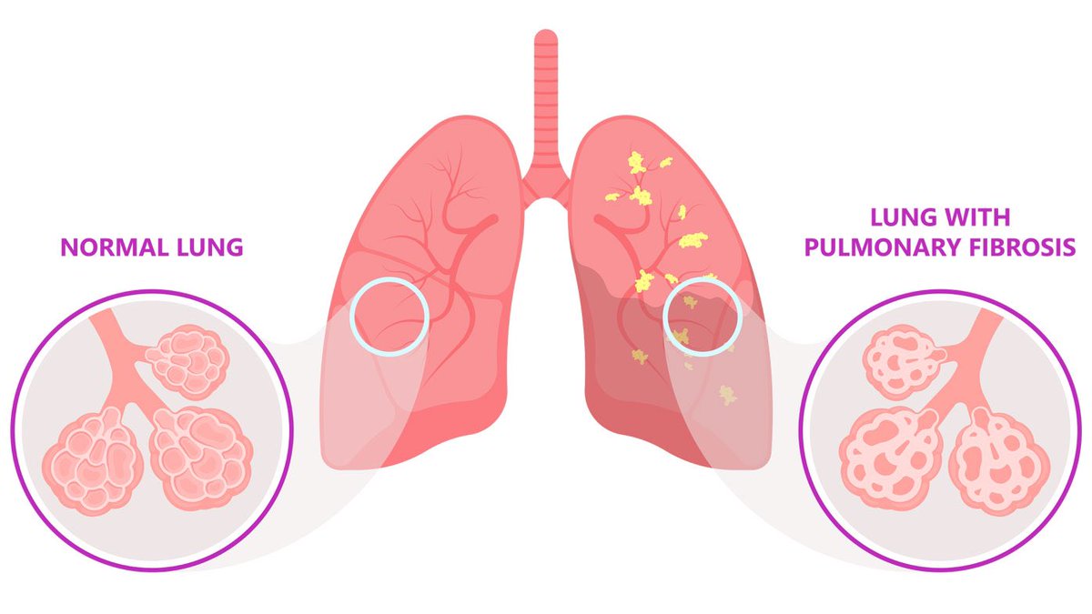 Inpatient Respiratory Nursing Team tweet media