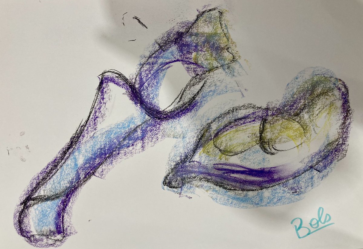 StopMsChampion's tweet image. We all had good fun at the first art workshop at Littleport for people affected by MS this afternoon, never thought I'd be drawing with a stick and ink or playing with charcoal and pastels..@mindsarts @mssocietyuk