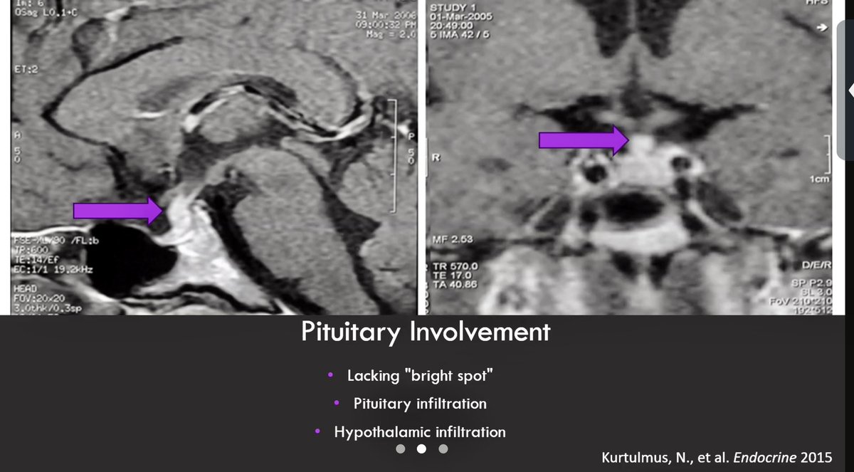 CU Anschutz Endocrinology tweet media