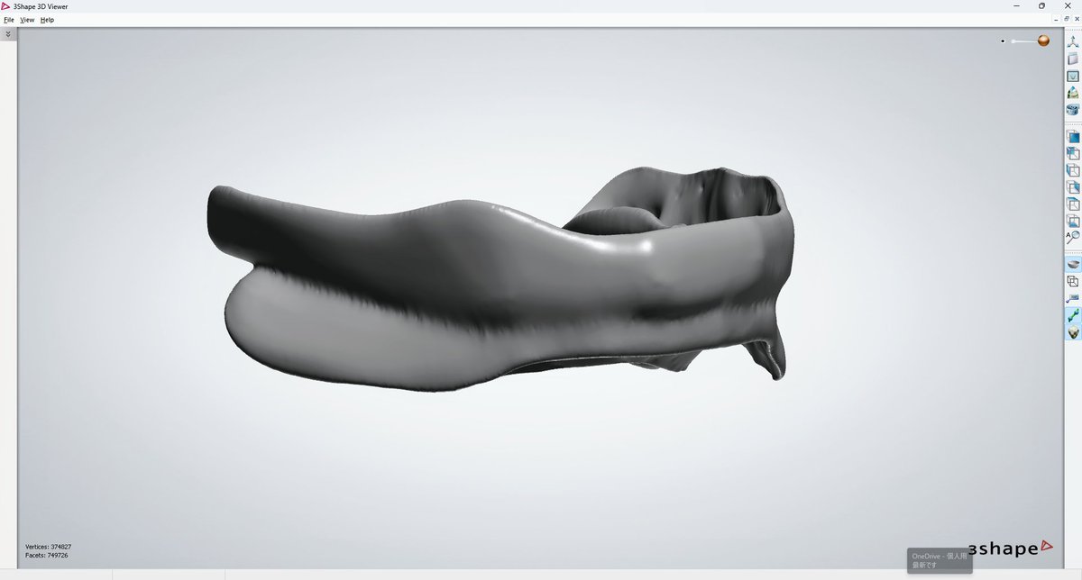 faithdentalate2's tweet image. Experimental sleep splint
#meditLink
#freesoft
#Whatyoucandowithfreesoftware
Can you prevent your lower jaw from moving backwards?