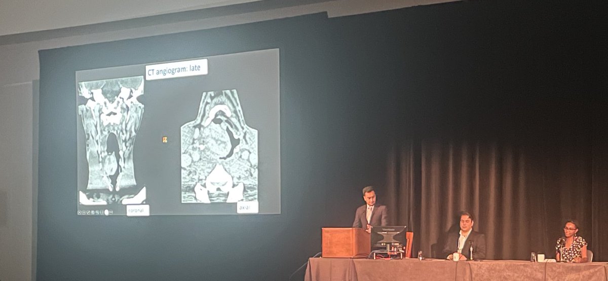Honored to have presented at the one of the first sessions at #ASHNR23 !! Grateful for this opportunity. Thank you to everyone who attended! Special shoutout to @AmitAgarwalMD for his guidance for this session and @Alok_A_Bhatt for helping me keep the nerves calm!