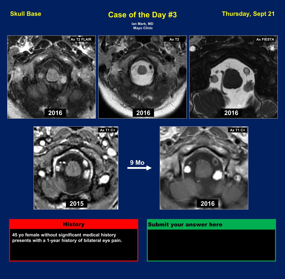 It's your time to shine 🌟 Post your answers as a GIF so all can enjoy. Tune in tomorrow for the answer. #ASHNR23 Case of the Day 3: @iantmark