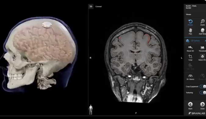 prevaricatos's tweet photo. Instalar #chips cerebrales 🧐bajo la excusa de "mejorar" aspectos cognitivos y "conectar" a los humanos. 

Argentina urgente requiere #leyes  para regular clonación y similares, bajo una óptica bioética 🔍 https://t.co/QnUKOBMChT