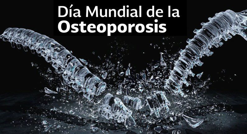 catitrans's tweet photo. #osteoporosis para su prevención es importante tener Vit D3 arriba de 30, calcio ingesta 1- 1.2g al día, ejercicio adecuados niveles hormonales! En CATI, te cuidamos para lograr prevenir! Recuerda hacer tu #chequeosalud https://t.co/bU1ZIRtJXK