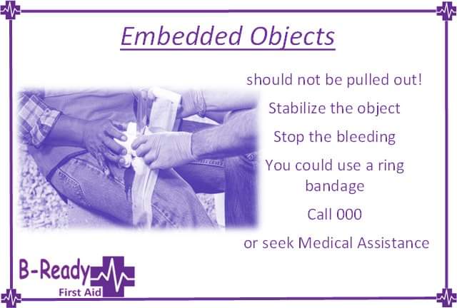 💜💜💜 Don't pull it out! Just Don't!  💜💜💜

#BReadyfirstaid #BReadyfirstaidtraining #Embeddedobject #emergency #firstaidtraininggatton #firstaidtrainingspringfield #firstaidtrainingcamira #firstaidtrainingbrisbane #woundmanagement #stopthebleeding