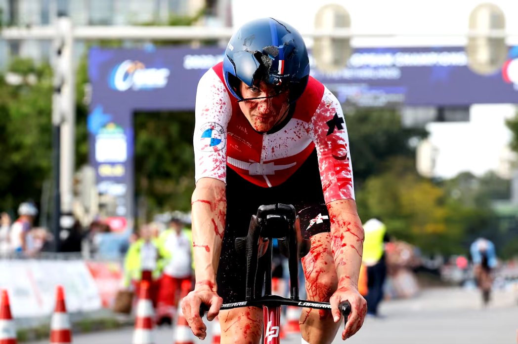 LeGruppetto's tweet photo. Après sa chute lors du chrono des championnats d'Europe, Stefan Küng souffre de deux fractures à la main, d'une fissure à la pommette et d'une commotion cérébrale. Le Suisse ne prendra pas le départ du relais mixte et devrait mettre un terme à sa saison selon le Het Nieuwsblad. https://t.co/Xf0pR9vUlk