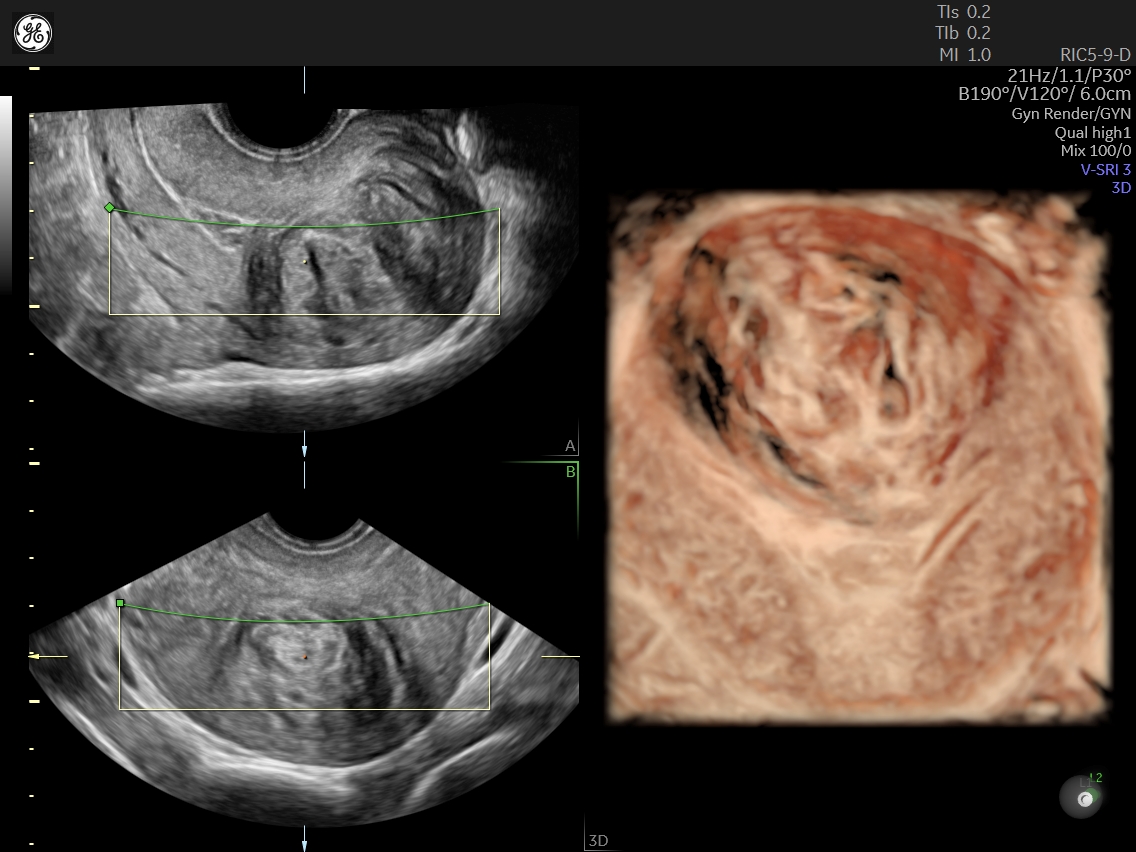 TheGrabner's tweet photo. Ultrasound is a tool - cannot be overlooked any more! Especially also for surgeons. https://t.co/IptCd2LerL