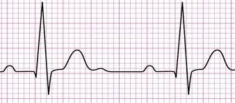 Still spaces available on todays Recording ECG’s class!! 

No need to book - just turn up!

Place: Pinewood House

Date: 21st September 2023

Time:   10.30-12.00