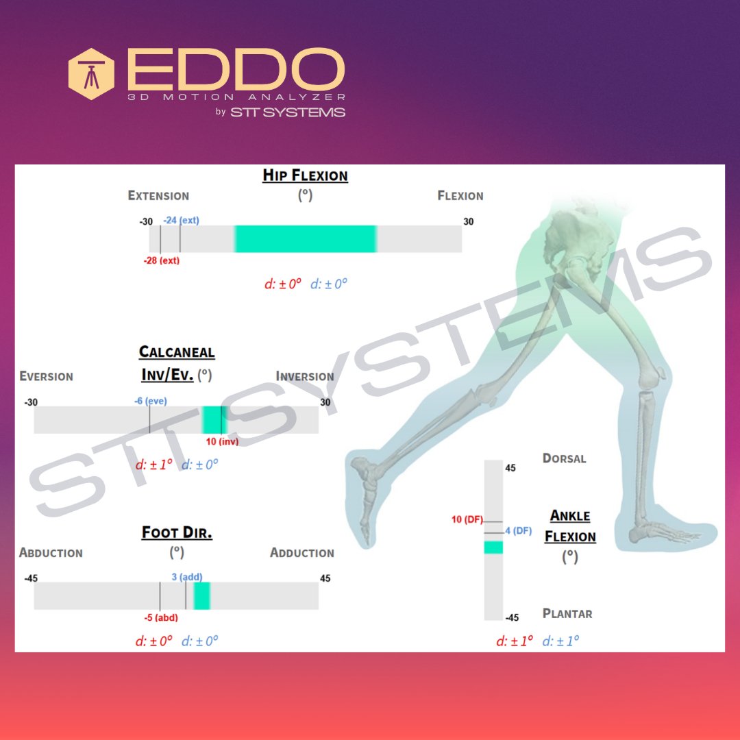 STT Systems tweet media