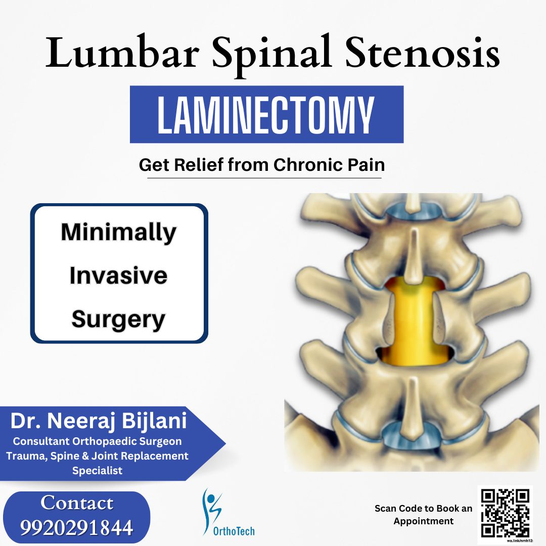Thecooldoc's tweet photo. This procedure is often performed to relieve pressure on the spinal cord or nerves caused by conditions like herniated discs, spinal stenosis, or tumors. 
#orthotech #mumbaikar #lumbarlordosis #orthopedic #mumbai #lumbarpain #laminectomy #bestsurgeon #mumbaiuntold https://t.co/IItszCOmo4