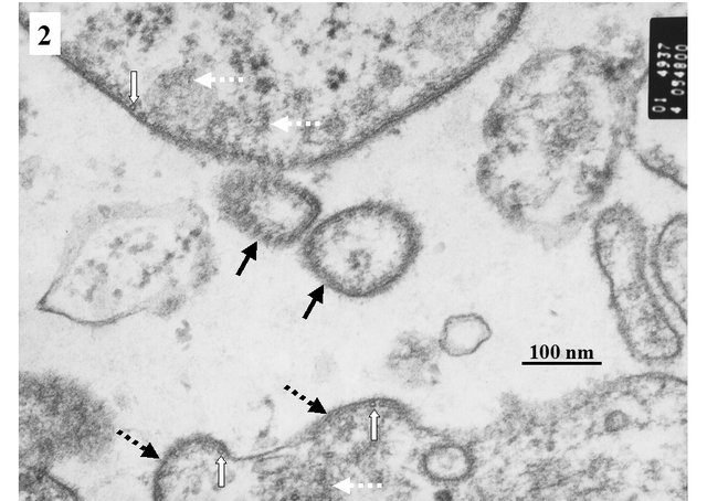 Dragon_IDoll's tweet photo. IRL, there exists a real southeastern virus : the Nipah virus. Which, beside its kawaii name, is known to infect the brain and cause death. Yeah… strange coincidences, right? 😼 https://t.co/HGc5RYvAQh