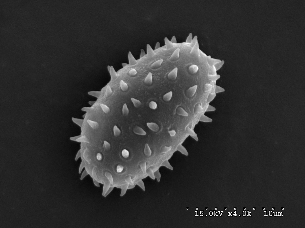 New paper just out on a new rust emerging across the southeastern United States -micrograph shows urediniospore frontiersin.org/articles/10.33…