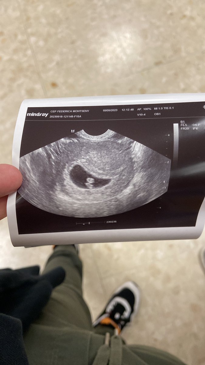 Baptistao tweet media