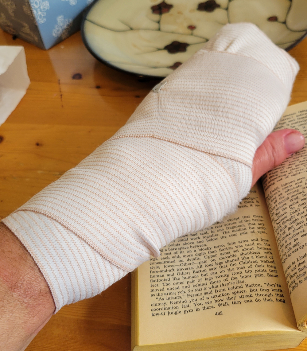 Last 10 days have been 1 of *those* stretches. Instead of making announcements I have been visiting the ER & typing 1-handed. Then yesterday website went down due to a DNS change gone wrong. But hand is on the mend & bppress.ca will be back up soon. Stay tuned!