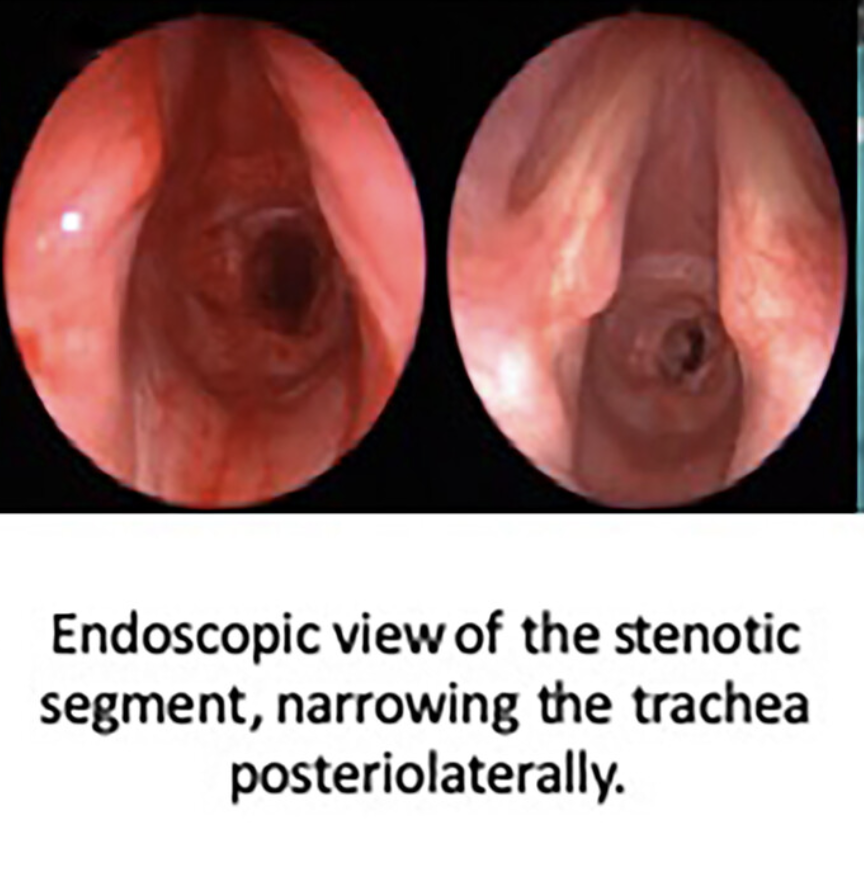Triological's tweet photo. Airway management. The #1 thing all otolaryngologists need to be well trained in. Check out this study.  #Triological #surgery #medicine #headnecksurgery #Laryngology  #medtwitter #laryngoscope #MedX
https://t.co/CofaWqKJCT https://t.co/8UsfduKg7C