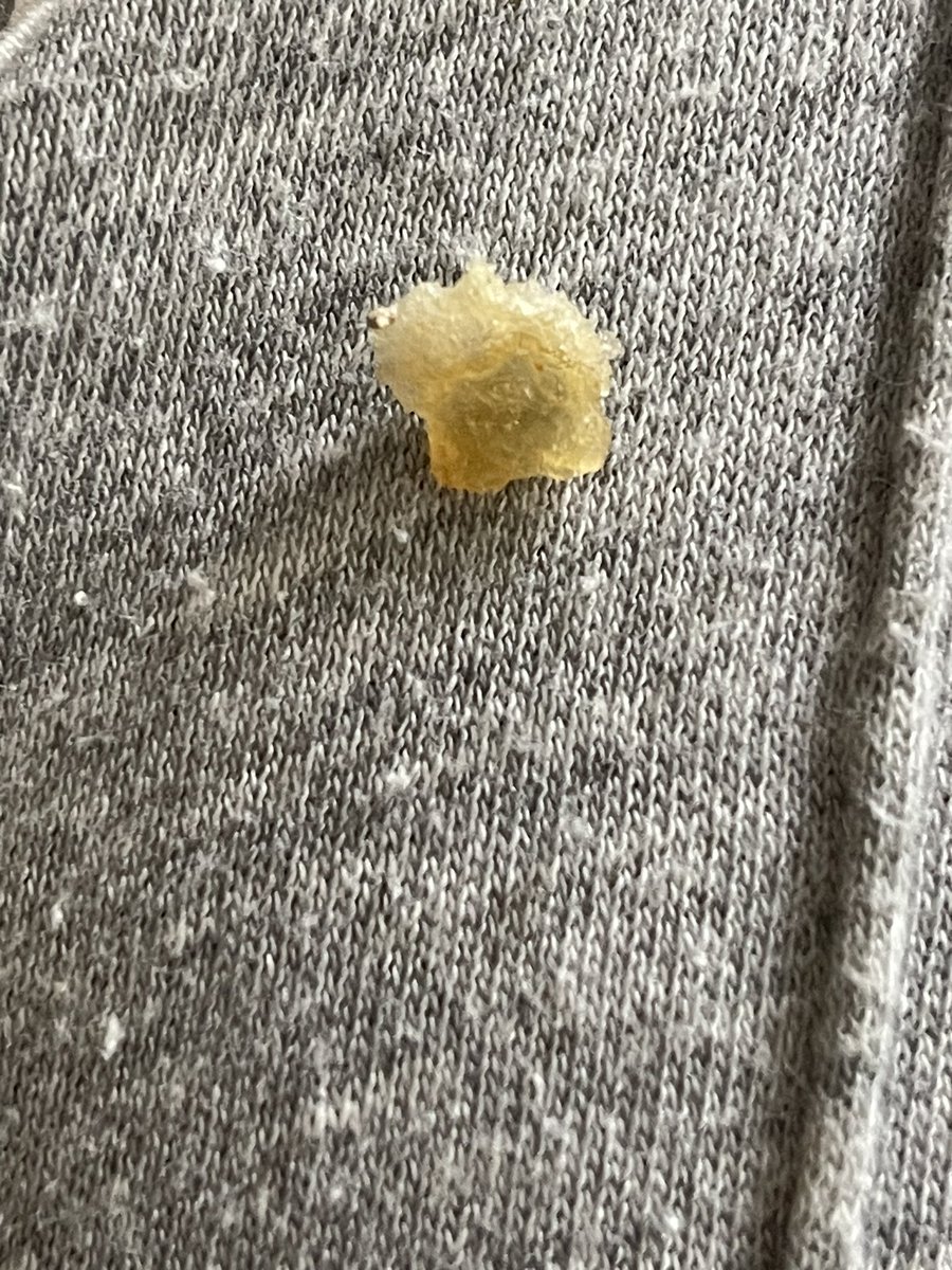 Life_of_summer_'s tweet photo. @PomBearUK  bit into a pombear crisp and chipped my tooth on this. It’s hard like plastic or glass https://t.co/KyH0ZyVq4x