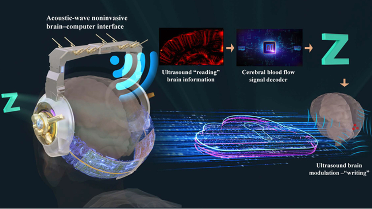 IEEE Brain (@ieeebrain) on Twitter photo New #research alert! <a href="/SPJournals/">Science Partner Journals</a> has a new article exploring the emergence of functional #ultrasound for noninvasive #brain–computer interfaces. It includes an overview of theory and development, highlights of the latest advancements, and more: bit.ly/45YHY7f #BCI New #research alert! <a href="/SPJournals/">Science Partner Journals</a> has a new article exploring the emergence of functional #ultrasound for noninvasive #brain–computer interfaces. It includes an overview of theory and development, highlights of the latest advancements, and more: bit.ly/45YHY7f #BCI