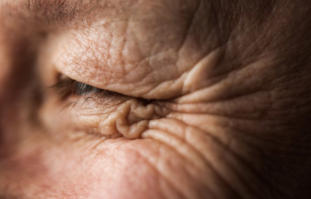 SammyOJoseph's tweet image. NOT going to like to read this, but it’s ok! Yet, the truth is that your crow-feet wrinkles, gulag-folds, tortoise-or-turtle-necks keep drawing ✍️ larger. You know what only thing that means: YOU’RE GROWING OLDER. DO WHAT YOU’VE GOTTA DO NOW FOR GOD AND HUMANITY

#DeeperTruths