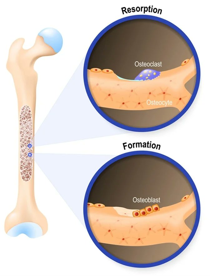 DietHeartNews's tweet photo. Calcium in supplements does not enter bone or promote bone density. The body manufactures the bone/mineral matrix. Best option: High(er) fat + mineral-rich foods. Magnesium - not calcium - has receptors on the  osteoblast bone-forming cells. If you supplement - do magnesium.