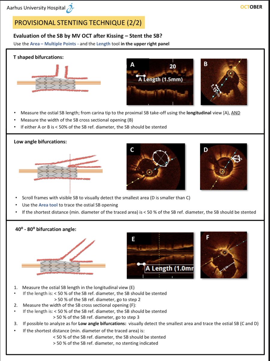 Dr Koltowski (@drkoltowski) on Twitter photo Time to the bring latest science to your CathLab.
Download step-by-step manual on how to perform OCT-guided PCI in bifurcations: ars.els-cdn.com/content/image/…
#OCT #PCI #EAPCI <a href="/escardio/">European Society of Cardiology</a> #OctoberTrial Time to the bring latest science to your CathLab.
Download step-by-step manual on how to perform OCT-guided PCI in bifurcations: ars.els-cdn.com/content/image/…
#OCT #PCI #EAPCI <a href="/escardio/">European Society of Cardiology</a> #OctoberTrial