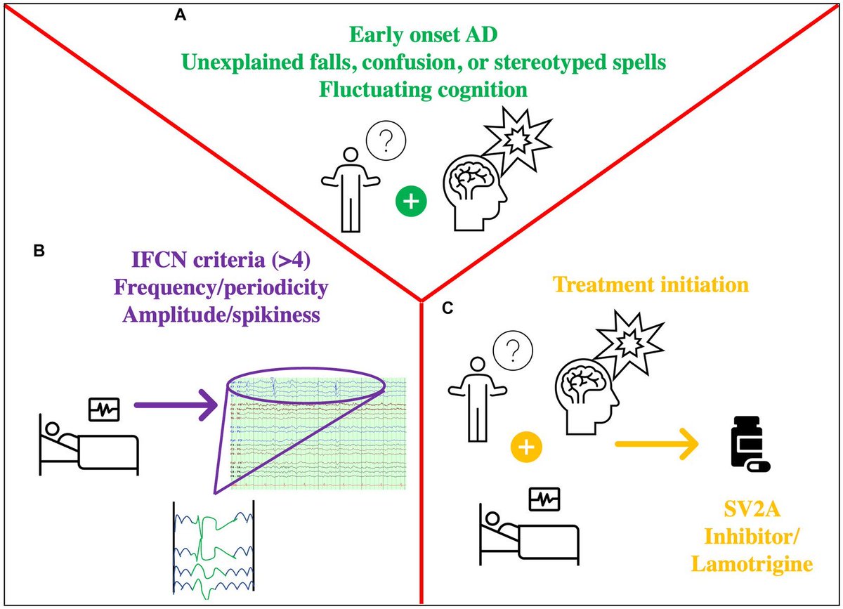 A patient with Alzheimer’s Dementia and an abnormal EEG? 🧐 check our latest review!