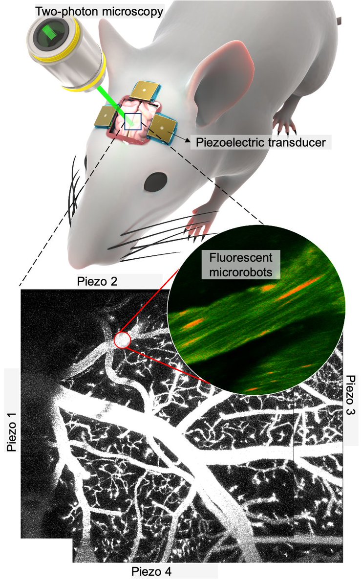 DanielAhmedARSL's tweet photo. I'm delighted to share our new paper in Nature Comm. Sound robots in the mouse brain vessels for the first time. New tech for treating neuro diseases. 
Congrats to @AlexiaCFonseca_ @mohamad_elamki  @ETH_en @eth_dmavt @UZH @SwissNeuro thanks @ERC_Research
https://t.co/Wunbm3gXBi https://t.co/tbK8Cv7XLV