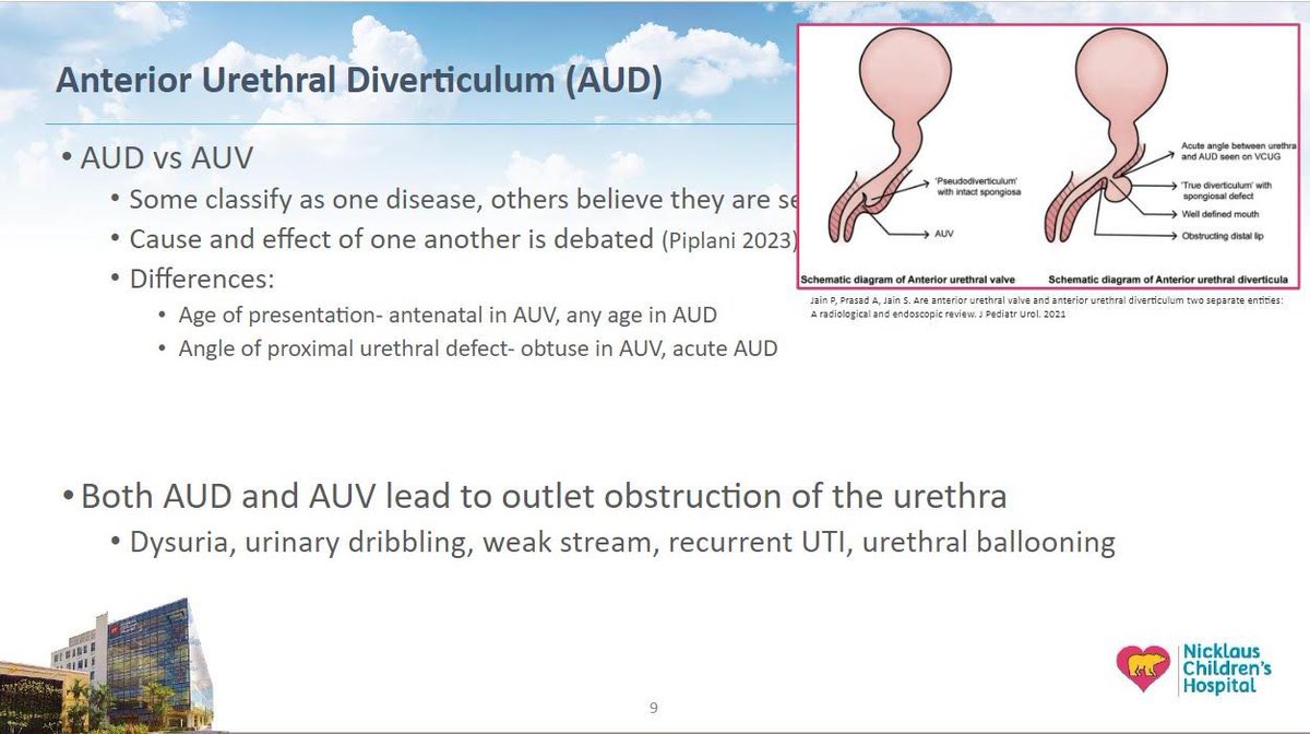 NCH/Miami PedUro Fellowship (@nchpedurofellow) on Twitter photo (Another) great job by our fellow <a href="/DMTbaum/">Daniel Tennenbaum 🎗️</a> presenting an interesting <a href="/FetalUrology/">Society for Fetal Urology</a> case at this year’s <a href="/SPU_Urology/">SPU_Urology</a> Fall Congress!
#PedUro #MedEd #Urology
<a href="/nicklausmeded/">Nicklaus Med Ed</a> <a href="/SectionOnPedUro/">Section on Pediatric Urology</a> (Another) great job by our fellow <a href="/DMTbaum/">Daniel Tennenbaum 🎗️</a> presenting an interesting <a href="/FetalUrology/">Society for Fetal Urology</a> case at this year’s <a href="/SPU_Urology/">SPU_Urology</a> Fall Congress!
#PedUro #MedEd #Urology
<a href="/nicklausmeded/">Nicklaus Med Ed</a> <a href="/SectionOnPedUro/">Section on Pediatric Urology</a>