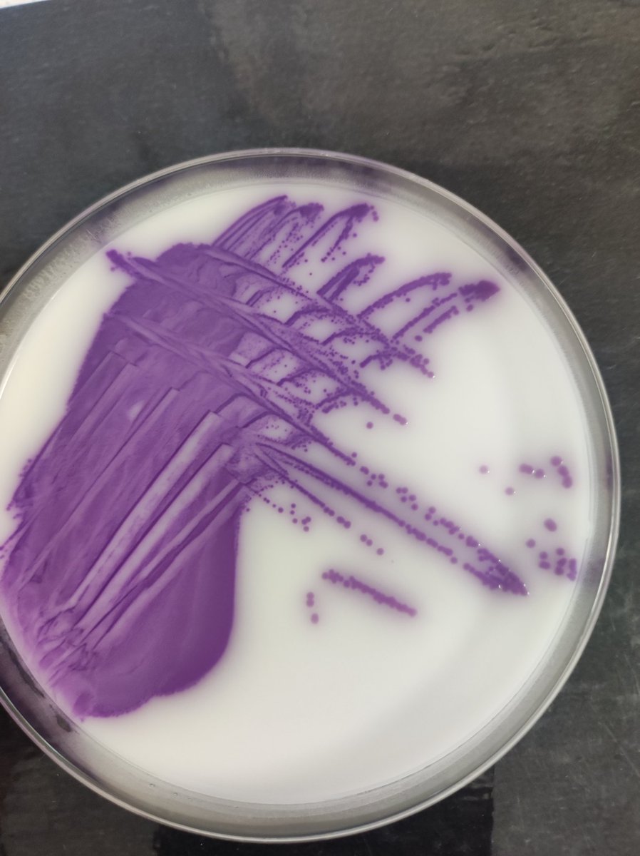 jcomls's tweet photo. How Salmonella species colonies look like on a chromogenic agar(SALM agar).

Even with this colour, advanced laboratories still go further for proper identification.

This is more reason, misidentification and or misdiagnosis is very reduced. https://t.co/hHCElrdbW4
