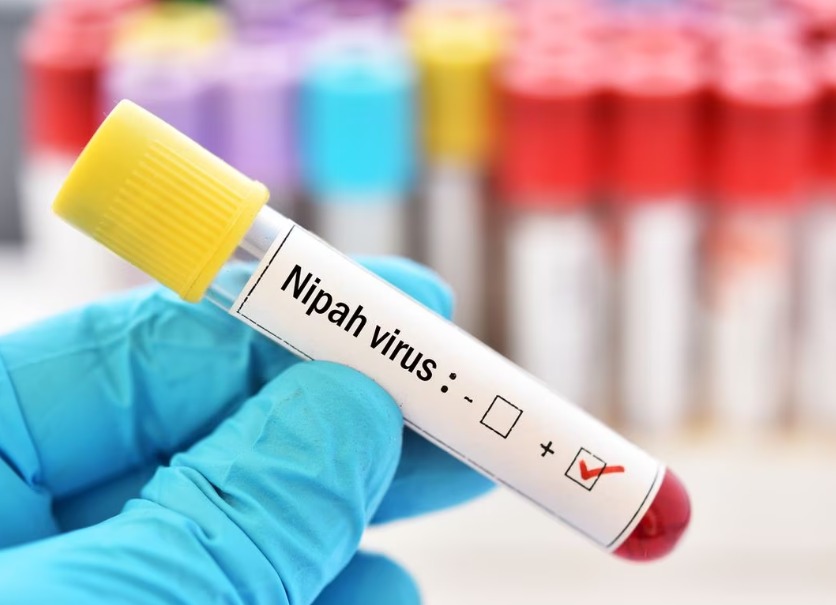 Sociedad de Epidemiología y Modelaje Matemático (@soepimoorg) on Twitter photo El virus de Nipah: cómo se transmite, síntomas y origen
Conoce más en:📎
prensa.com/sociedad/el-vi…
<a href="/JeanCarrPaul/">Jean-Paul Carrera</a> El virus de Nipah: cómo se transmite, síntomas y origen
Conoce más en:📎
prensa.com/sociedad/el-vi…
<a href="/JeanCarrPaul/">Jean-Paul Carrera</a>