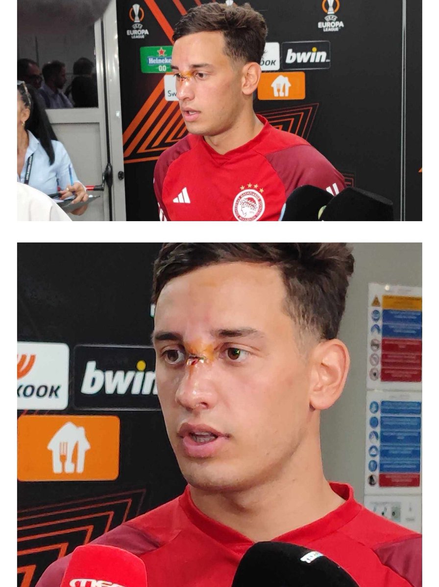 TheSlothOfBtc's tweet photo. #europeague #uefa #var #olympiacosfc #OLYFRE
A #Freiburg player broke the nose of Santiago Hezze with his elbow and the referee did not give a foul, did not even see the VAR. Please see again the video. https://t.co/ApujqGHZec