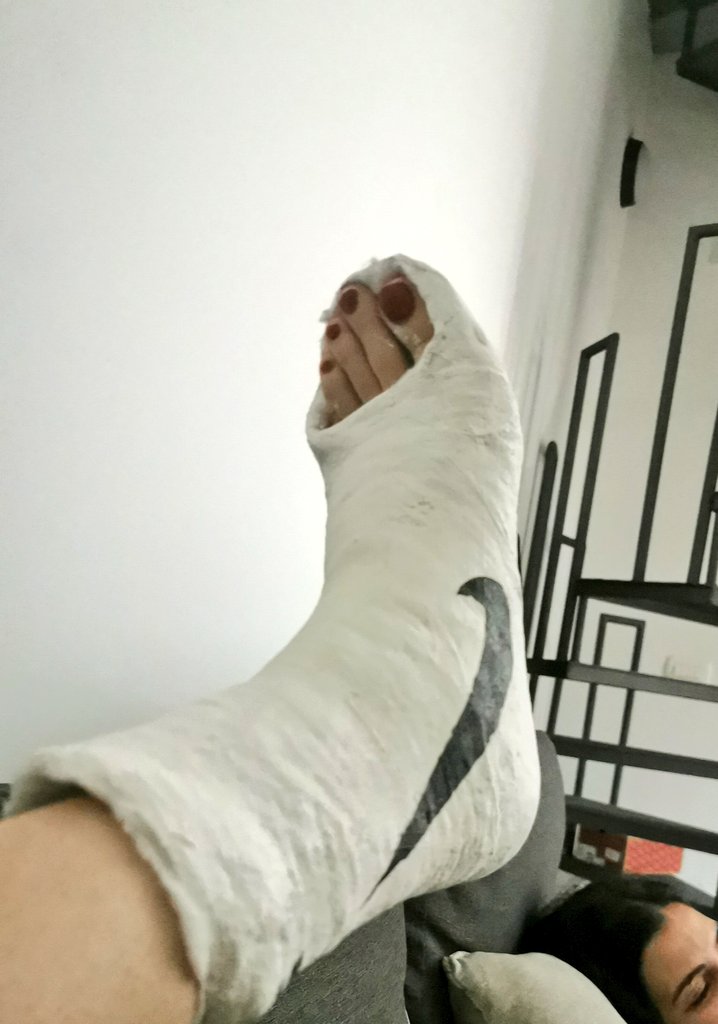 Yurt dışına çıkıpta ayağını kıran bi aptal benim galiba