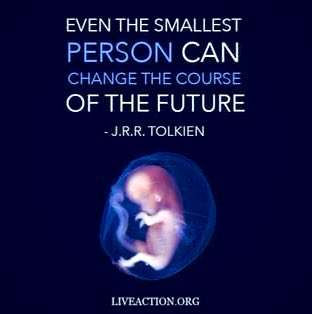 We must always defend the unborn until abortion is abolished. #AllLivesMatter #DefendLife #AbolishAbortion #AbortionIsMurder #ProLife